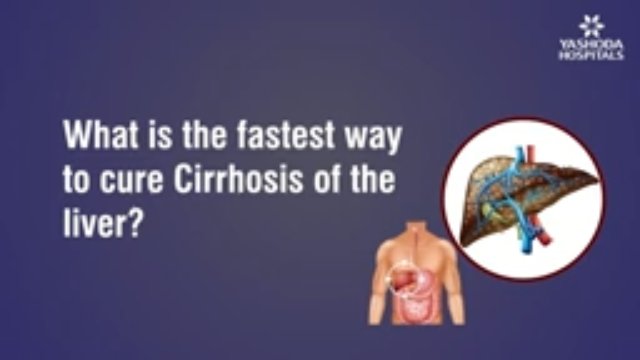 Liver Cirrhosis: Complications, Scoring Systems & Step-by-Step Management